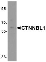 CTNNBL1 Antibody in Western Blot (WB)