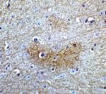 GLS2 Antibody in Immunohistochemistry (IHC)