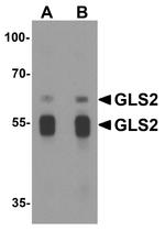 GLS2 Antibody in Western Blot (WB)