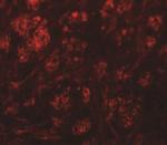 Rabex-5 Antibody in Immunohistochemistry (IHC)