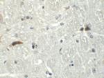 Rabex-5 Antibody in Immunohistochemistry (IHC)