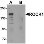 ROCK1 Antibody in Western Blot (WB)