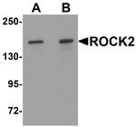 ROCK2 Antibody in Western Blot (WB)