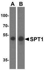 SPTLC1 Antibody in Western Blot (WB)