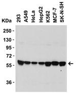 SPTLC2 Antibody in Western Blot (WB)