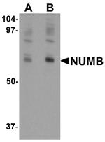 NUMB Antibody in Western Blot (WB)