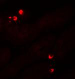 SGK1 Antibody in Immunohistochemistry (IHC)