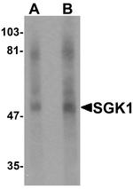 SGK1 Antibody in Western Blot (WB)