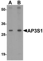 AP3S1 Antibody in Western Blot (WB)