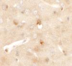 CCDC141 Antibody in Immunohistochemistry (IHC)