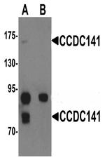 CCDC141 Antibody in Western Blot (WB)