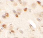 SPRYD2 Antibody in Immunohistochemistry (IHC)