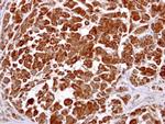 LHR Antibody in Immunohistochemistry (Paraffin) (IHC (P))