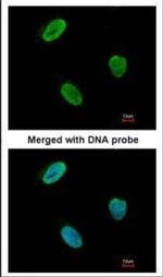 RAD9 Antibody in Immunocytochemistry (ICC/IF)