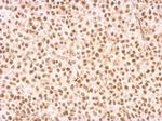 RAD9 Antibody in Immunohistochemistry (Paraffin) (IHC (P))