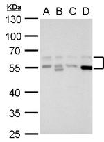 RAD9 Antibody in Western Blot (WB)