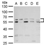 RAD9 Antibody in Western Blot (WB)