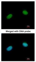 XRCC3 Antibody in Immunocytochemistry (ICC/IF)