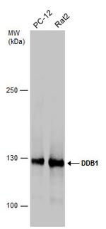 DDB1 Antibody in Western Blot (WB)