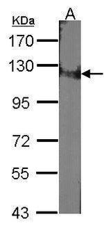 DDB1 Antibody in Western Blot (WB)