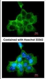 DOCK1 Antibody in Immunocytochemistry (ICC/IF)