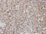 DOCK1 Antibody in Immunohistochemistry (Paraffin) (IHC (P))