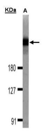 DOCK1 Antibody in Western Blot (WB)