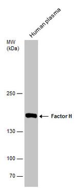 Complement Factor H Antibody in Western Blot (WB)