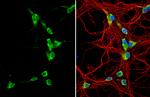 GALR2 Antibody in Immunocytochemistry (ICC/IF)