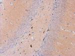 GALR2 Antibody in Immunohistochemistry (Paraffin) (IHC (P))