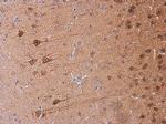 GALR2 Antibody in Immunohistochemistry (Paraffin) (IHC (P))