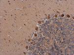 GALR2 Antibody in Immunohistochemistry (Paraffin) (IHC (P))