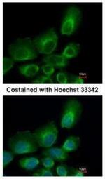 UBE2B Antibody in Immunocytochemistry (ICC/IF)