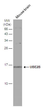 UBE2B Antibody in Western Blot (WB)