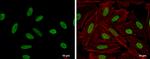 HMGA2 Antibody in Immunocytochemistry (ICC/IF)