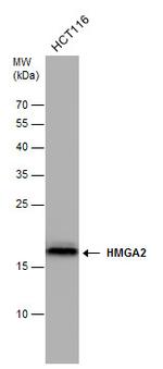 HMGA2 Antibody in Western Blot (WB)