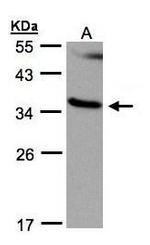 RASSF1 Antibody in Western Blot (WB)