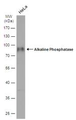 ALPL Antibody in Western Blot (WB)