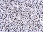 Glucocorticoid Receptor Antibody in Immunohistochemistry (Paraffin) (IHC (P))