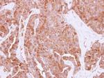 HPRT1 Antibody in Immunohistochemistry (Paraffin) (IHC (P))