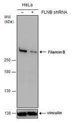 Filamin B Antibody