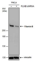 Filamin B Antibody