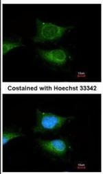 GBA Antibody in Immunocytochemistry (ICC/IF)