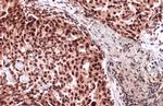 ATRX Antibody in Immunohistochemistry (Paraffin) (IHC (P))