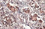 ATRX Antibody in Immunohistochemistry (Paraffin) (IHC (P))