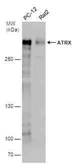 ATRX Antibody in Western Blot (WB)