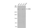 ATRX Antibody in Western Blot (WB)