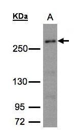 CAD Antibody in Western Blot (WB)