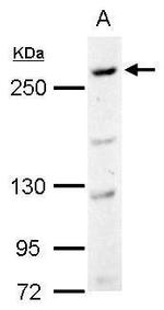 CAD Antibody in Western Blot (WB)