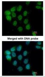 A-Raf Antibody in Immunocytochemistry (ICC/IF)